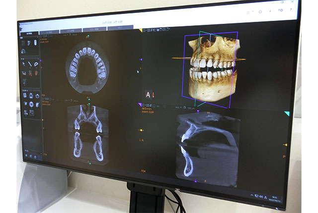 歯科用CT装置