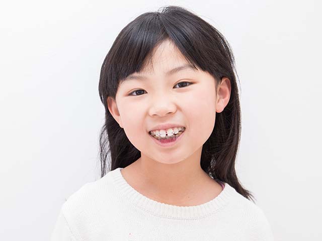 小児矯正治療について