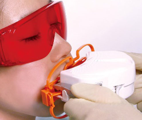 オフィスホワイトニング