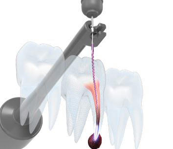 高周波通電装置